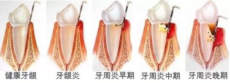 种植牙的发展趋势与市场分析：牙博士引领行业潮流