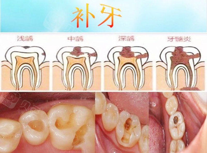 牙齿矫正：从微笑到自信的蜕变